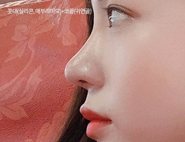 눈, 코 성형 중점 더페이스성형외과 눈, 코 성형 중점 더페이스성형외과